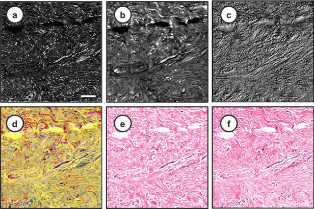 Figure 4 for Virtual Histological Staining of Label-Free Total Absorption Photoacoustic Remote Sensing (TA-PARS)