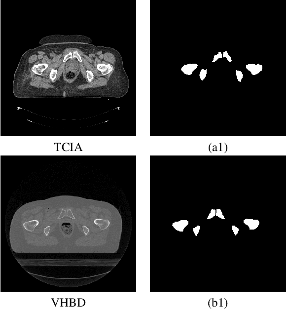 Figure 1 for Boosting Segmentation Performance across datasets using histogram specification with application to pelvic bone segmentation