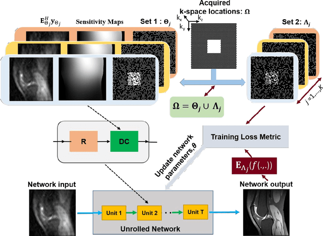 Figure 1 for Multi-Mask Self-Supervised Learning for Physics-Guided Neural Networks in Highly Accelerated MRI