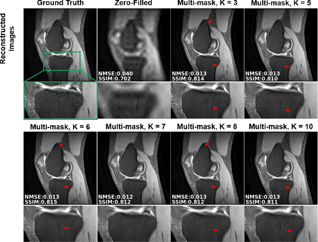Figure 2 for Multi-Mask Self-Supervised Learning for Physics-Guided Neural Networks in Highly Accelerated MRI