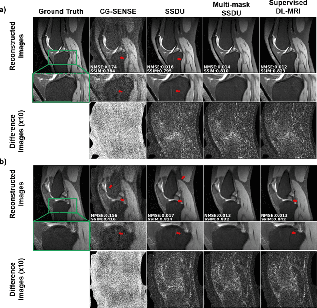 Figure 3 for Multi-Mask Self-Supervised Learning for Physics-Guided Neural Networks in Highly Accelerated MRI