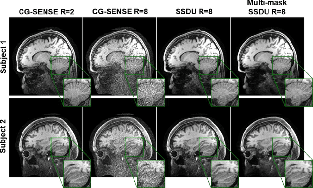 Figure 4 for Multi-Mask Self-Supervised Learning for Physics-Guided Neural Networks in Highly Accelerated MRI