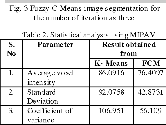Figure 3 for Segmentation of Alzheimers Disease in PET scan datasets using MATLAB