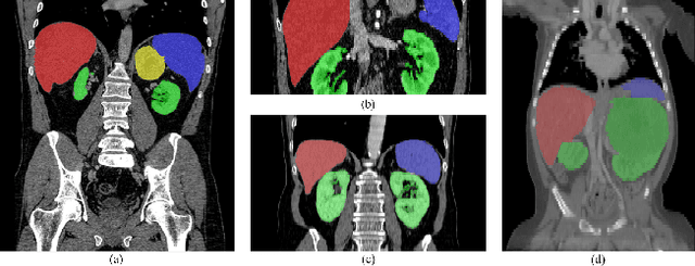 Figure 1 for Efficient Context-Aware Network for Abdominal Multi-organ Segmentation