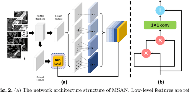 Figure 3 for Multi-Scale Attentional Network for Multi-Focal Segmentation of Active Bleed after Pelvic Fractures