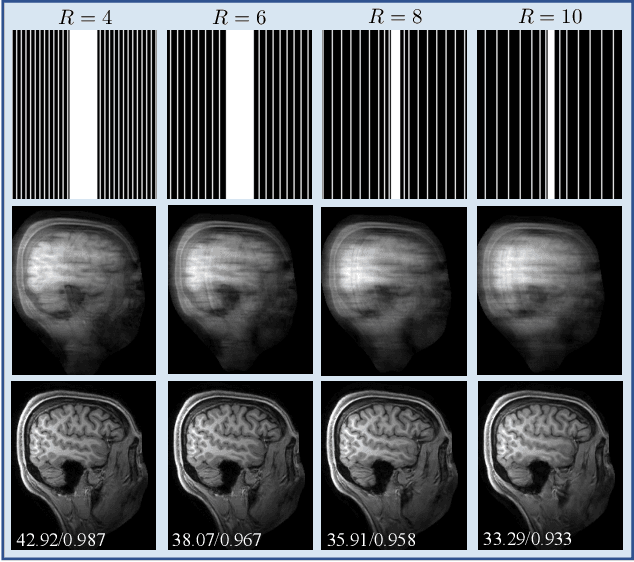 Figure 3 for SPICE: Self-Supervised Learning for MRI with Automatic Coil Sensitivity Estimation