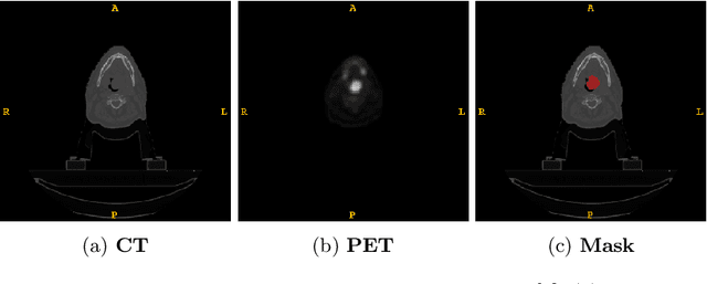 Figure 1 for An Ensemble Approach for Patient Prognosis of Head and Neck Tumor Using Multimodal Data