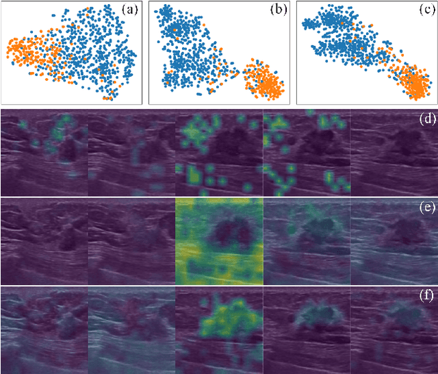 Figure 4 for Masked Video Modeling with Correlation-aware Contrastive Learning for Breast Cancer Diagnosis in Ultrasound