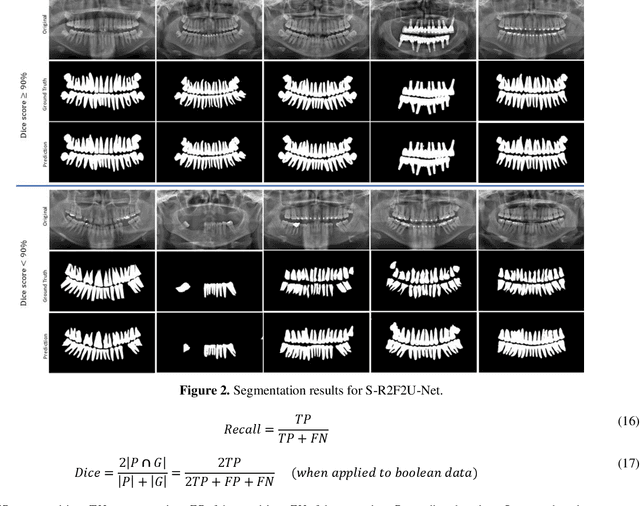 Figure 4 for S-R2F2U-Net: A single-stage model for teeth segmentation