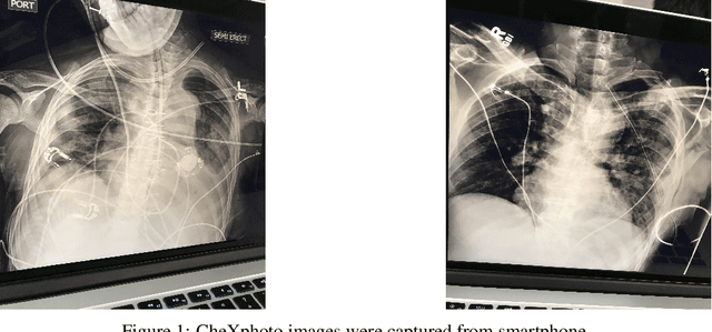 Figure 1 for A novel approach to remove foreign objects from chest X-ray images