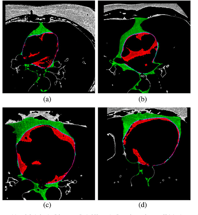 Figure 3 for Machine learning in the prediction of cardiac epicardial and mediastinal fat volumes