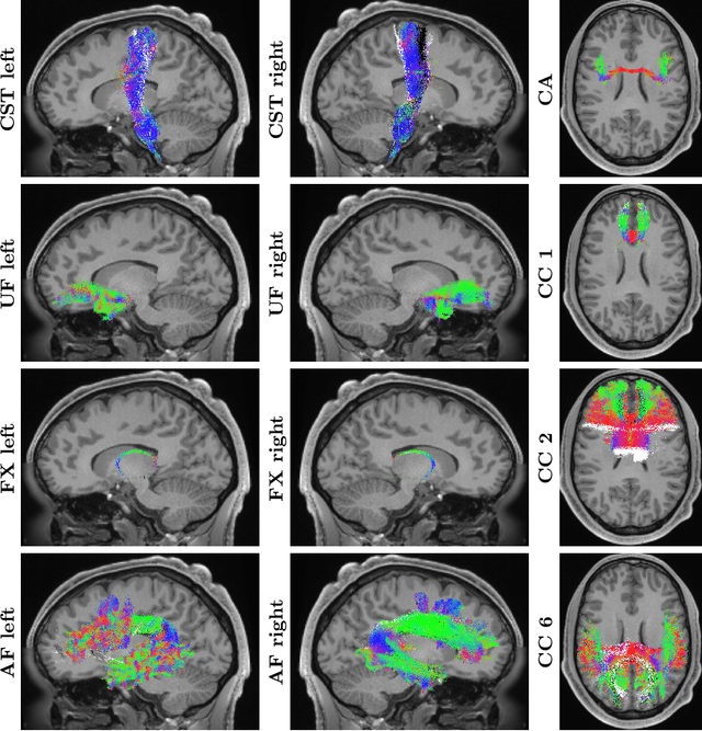 Figure 4 for DeepBundle: Fiber Bundle Parcellation with Graph Convolution Neural Networks