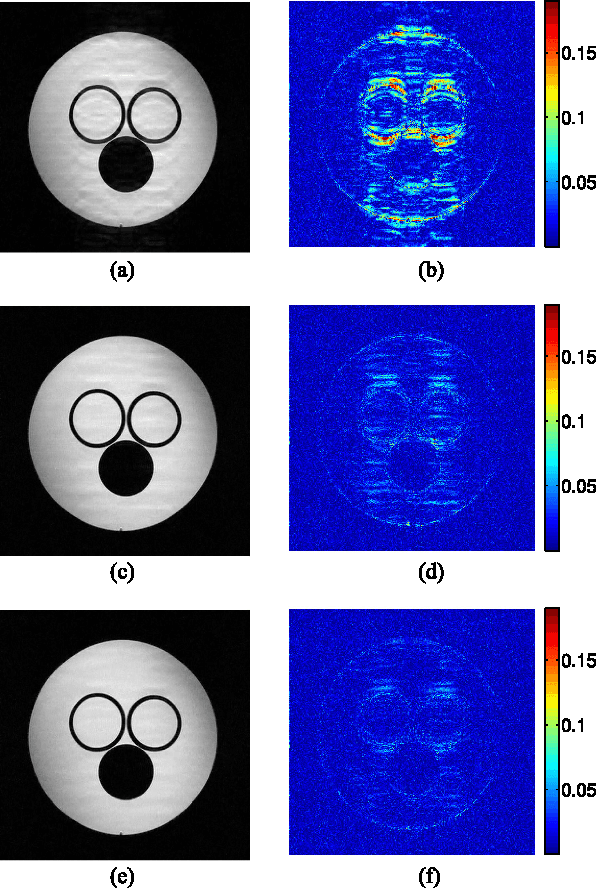 Figure 4 for Data-Driven Learning of a Union of Sparsifying Transforms Model for Blind Compressed Sensing
