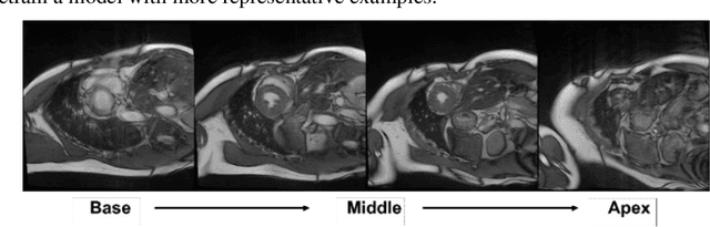 Figure 3 for Motion-related Artefact Classification Using Patch-based Ensemble and Transfer Learning in Cardiac MRI