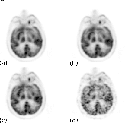 Figure 1 for 200x Low-dose PET Reconstruction using Deep Learning