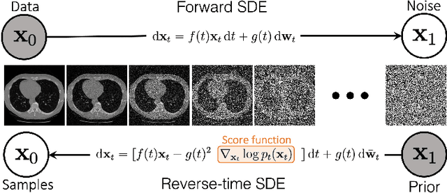 Figure 1 for Solving Inverse Problems in Medical Imaging with Score-Based Generative Models