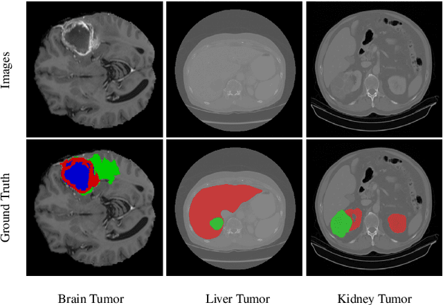 Figure 1 for TransBTSV2: Wider Instead of Deeper Transformer for Medical Image Segmentation