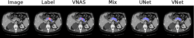 Figure 3 for V-NAS: Neural Architecture Search for Volumetric Medical Image Segmentation