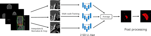 Figure 3 for Automatic Segmentation of Gross Target Volume of Nasopharynx Cancer using Ensemble of Multiscale Deep Neural Networks with Spatial Attention