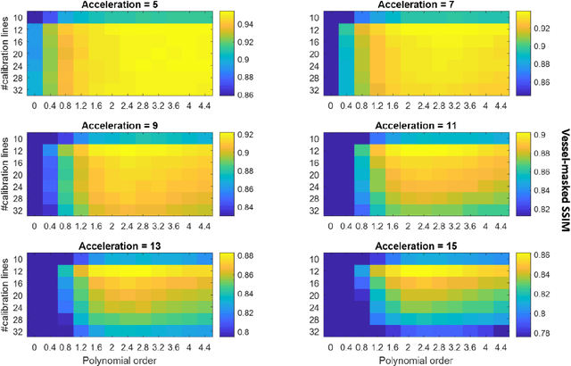 Figure 2 for Optimization of Undersampling Parameters for 3D Intracranial Compressed Sensing MR Angiography at 7 Tesla