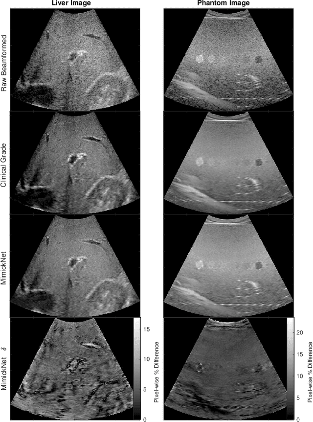 Figure 3 for MimickNet, Matching Clinical Post-Processing Under Realistic Black-Box Constraints