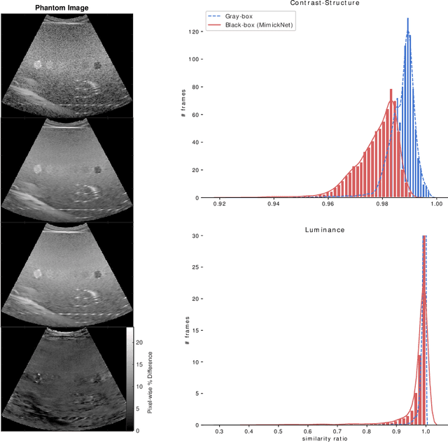 Figure 4 for MimickNet, Matching Clinical Post-Processing Under Realistic Black-Box Constraints