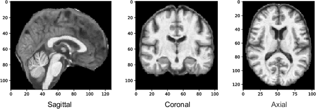 Figure 3 for Self-PU: Self Boosted and Calibrated Positive-Unlabeled Training