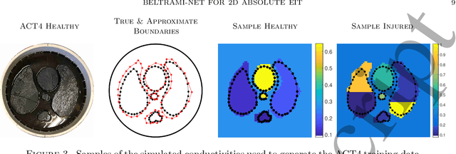 Figure 4 for Beltrami-Net: Domain Independent Deep D-bar Learning for Absolute Imaging with Electrical Impedance Tomography (a-EIT)