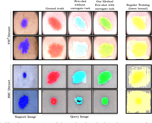 Figure 4 for Semi-supervised few-shot learning for medical image segmentation