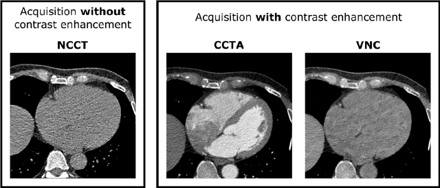 Figure 1 for Deep Learning from Dual-Energy Information for Whole-Heart Segmentation in Dual-Energy and Single-Energy Non-Contrast-Enhanced Cardiac CT