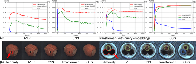 Figure 2 for A Unified Model for Multi-class Anomaly Detection