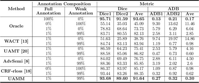 Figure 3 for A Macro-Micro Weakly-supervised Framework for AS-OCT Tissue Segmentation