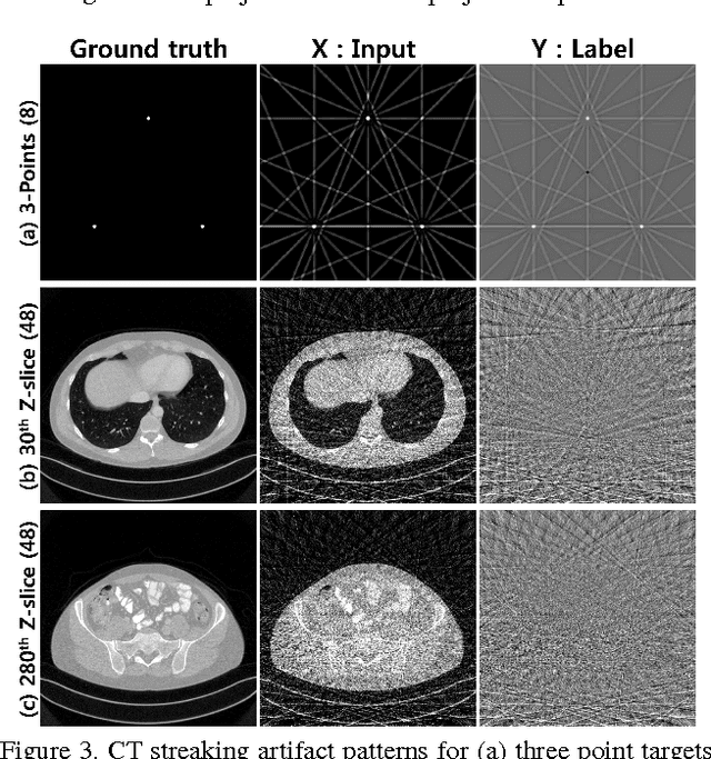 Figure 4 for Deep Residual Learning for Compressed Sensing CT Reconstruction via Persistent Homology Analysis