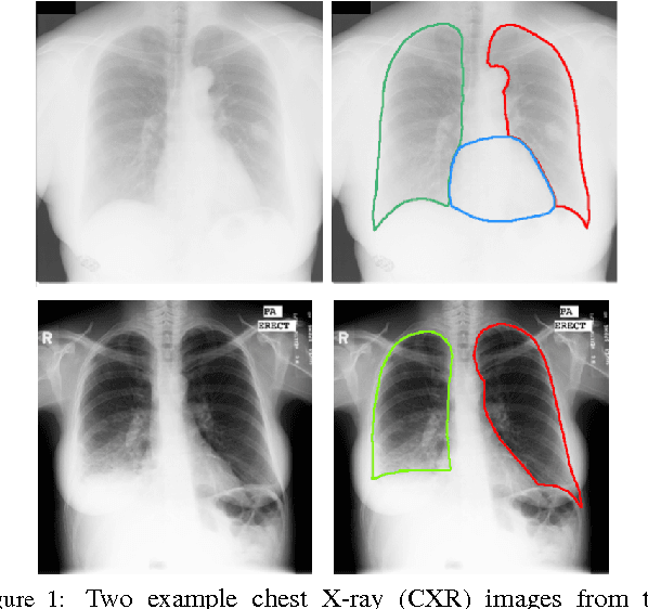Figure 1 for SCAN: Structure Correcting Adversarial Network for Organ Segmentation in Chest X-rays