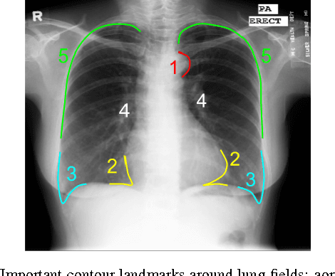 Figure 3 for SCAN: Structure Correcting Adversarial Network for Organ Segmentation in Chest X-rays