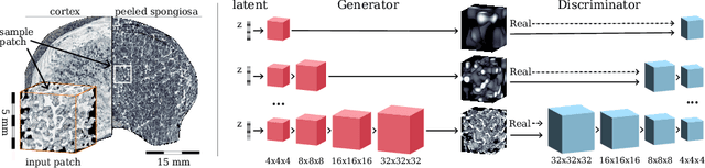 Figure 1 for Generative Modelling of 3D in-silico Spongiosa with Controllable Micro-Structural Parameters