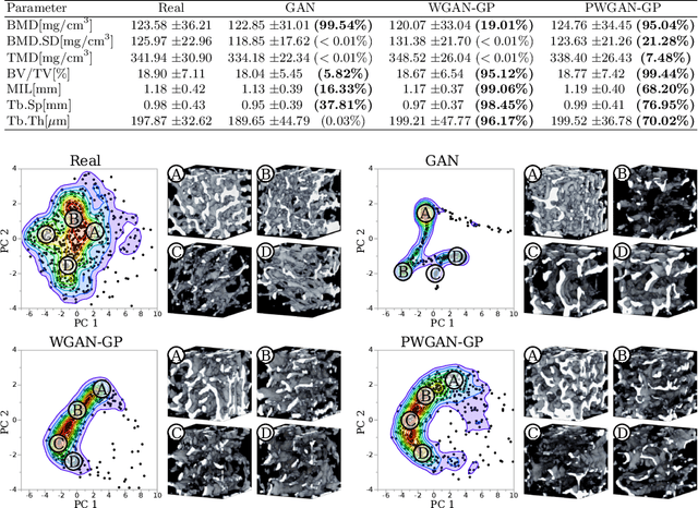 Figure 2 for Generative Modelling of 3D in-silico Spongiosa with Controllable Micro-Structural Parameters