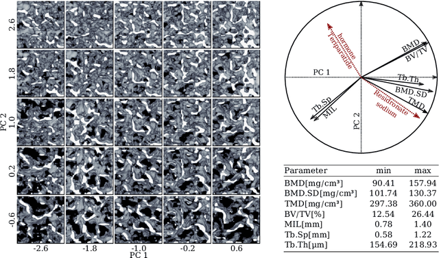 Figure 3 for Generative Modelling of 3D in-silico Spongiosa with Controllable Micro-Structural Parameters