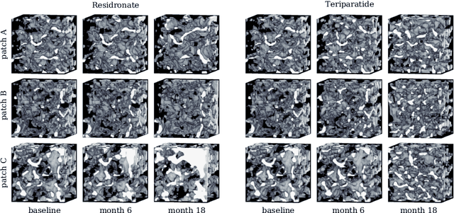 Figure 4 for Generative Modelling of 3D in-silico Spongiosa with Controllable Micro-Structural Parameters