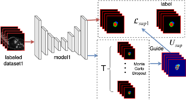 Figure 1 for Uncertainty-Aware Deep Co-training for Semi-supervised Medical Image Segmentation