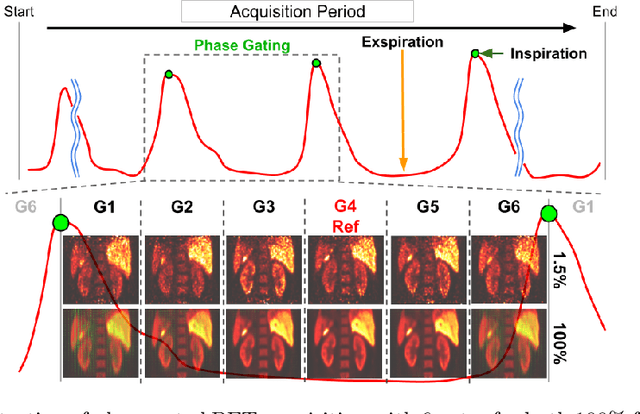 Figure 1 for Simultaneous Denoising and Motion Estimation for Low-dose Gated PET using a Siamese Adversarial Network with Gate-to-Gate Consistency Learning