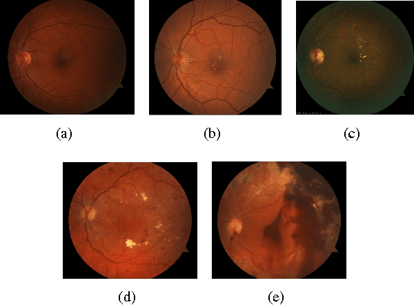 Figure 1 for Neural Networks with Manifold Learning for Diabetic Retinopathy Detection