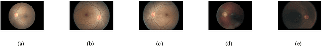 Figure 3 for Neural Networks with Manifold Learning for Diabetic Retinopathy Detection