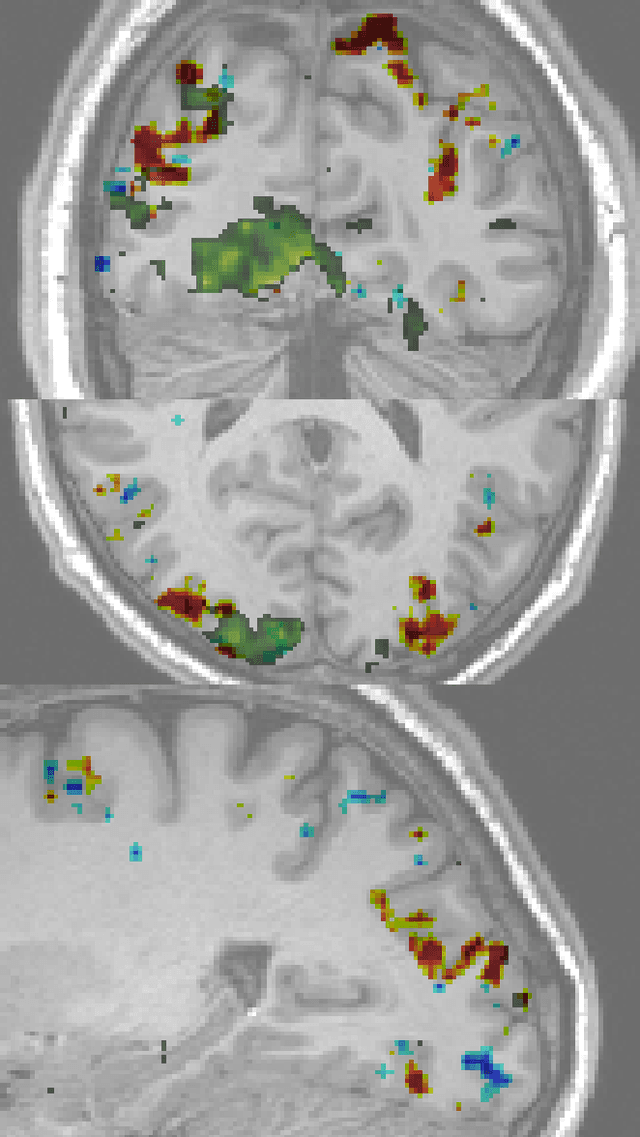 Figure 4 for Second order scattering descriptors predict fMRI activity due to visual textures