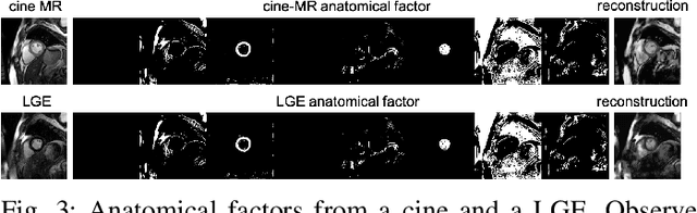 Figure 3 for Disentangle, align and fuse for multimodal and zero-shot image segmentation