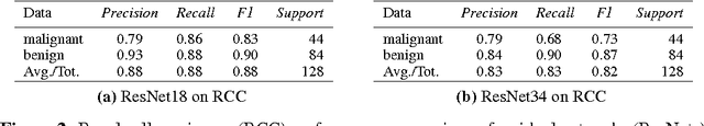 Figure 2 for Multi-Organ Cancer Classification and Survival Analysis