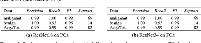 Figure 3 for Multi-Organ Cancer Classification and Survival Analysis