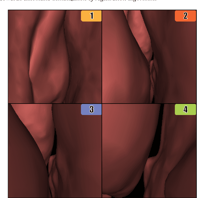 Figure 2 for Towards automatic initialization of registration algorithms using simulated endoscopy images