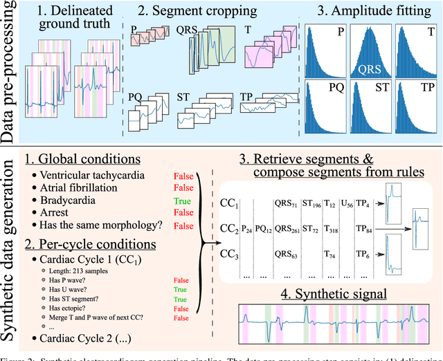 Figure 3 for Generalizing electrocardiogram delineation: training convolutional neural networks with synthetic data augmentation