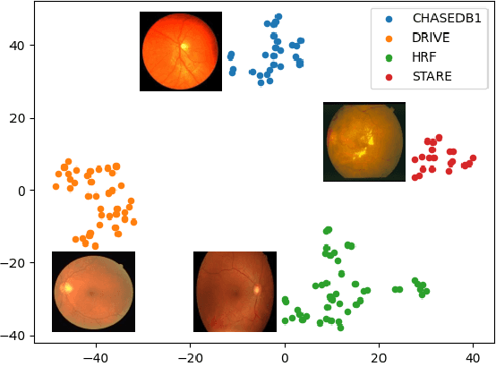 Figure 1 for AADG: Automatic Augmentation for Domain Generalization on Retinal Image Segmentation